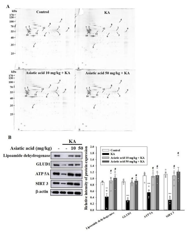 GluD1 Antibody in Western Blot (WB)