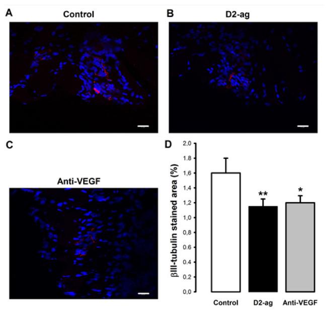 beta-3 Tubulin Antibody in Immunocytochemistry (ICC/IF)