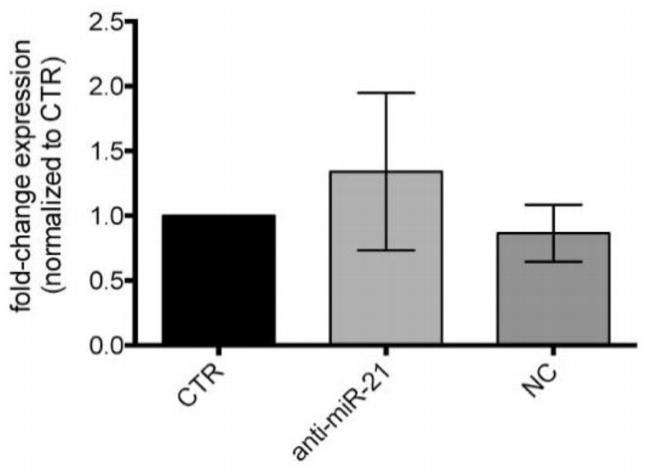 STAT3 Antibody in Western Blot (WB)