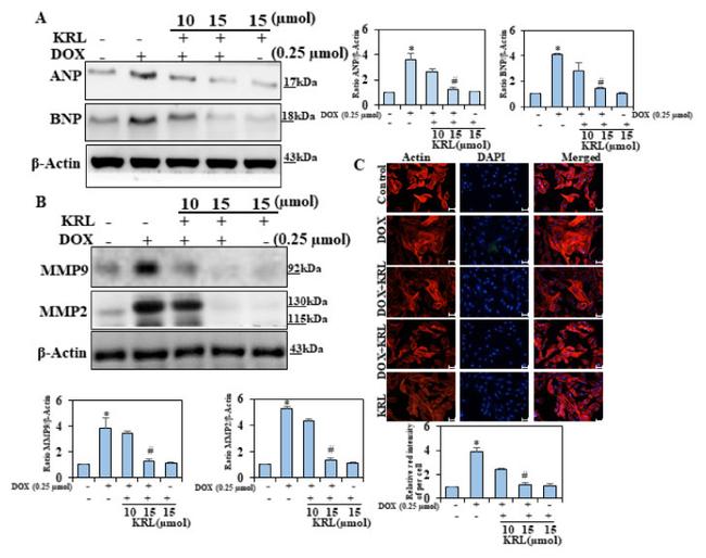 MMP2 Antibody in Western Blot (WB)