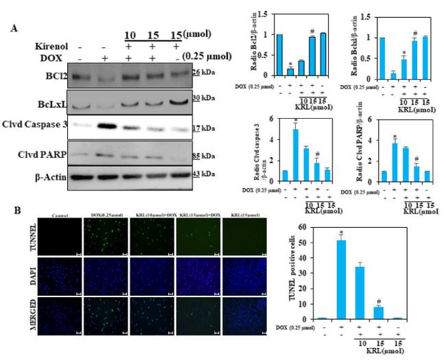 Bcl-2 Antibody in Western Blot (WB)