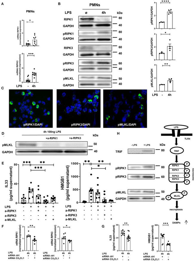 RIP1 Antibody in Western Blot (WB)