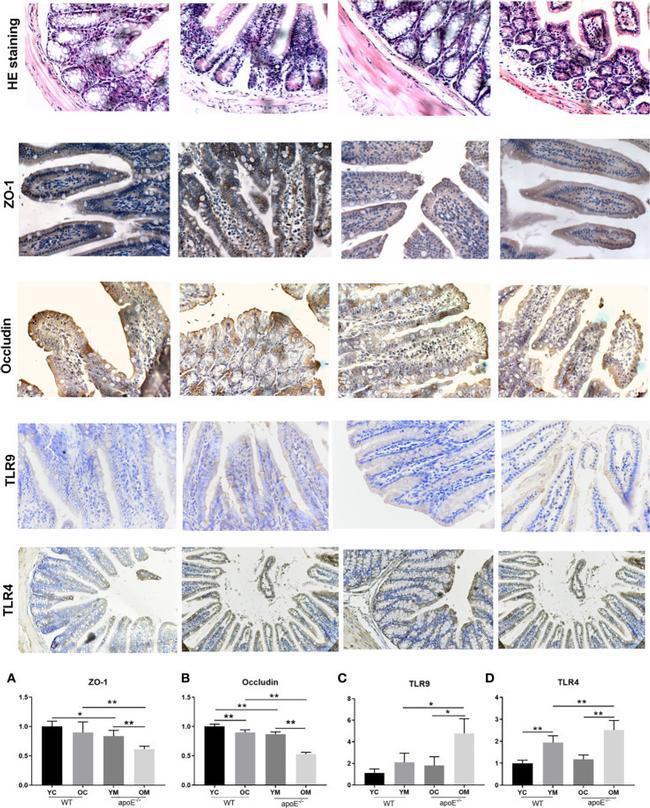 ZO-1 Antibody in Immunohistochemistry (IHC)