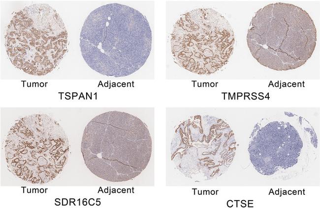 SDR16C5 Antibody in Immunohistochemistry (IHC)