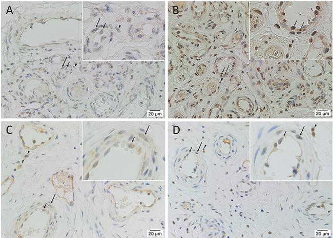 SOX2 Antibody in Immunohistochemistry (IHC)