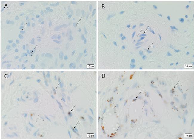 SOX2 Antibody in Immunohistochemistry (IHC)