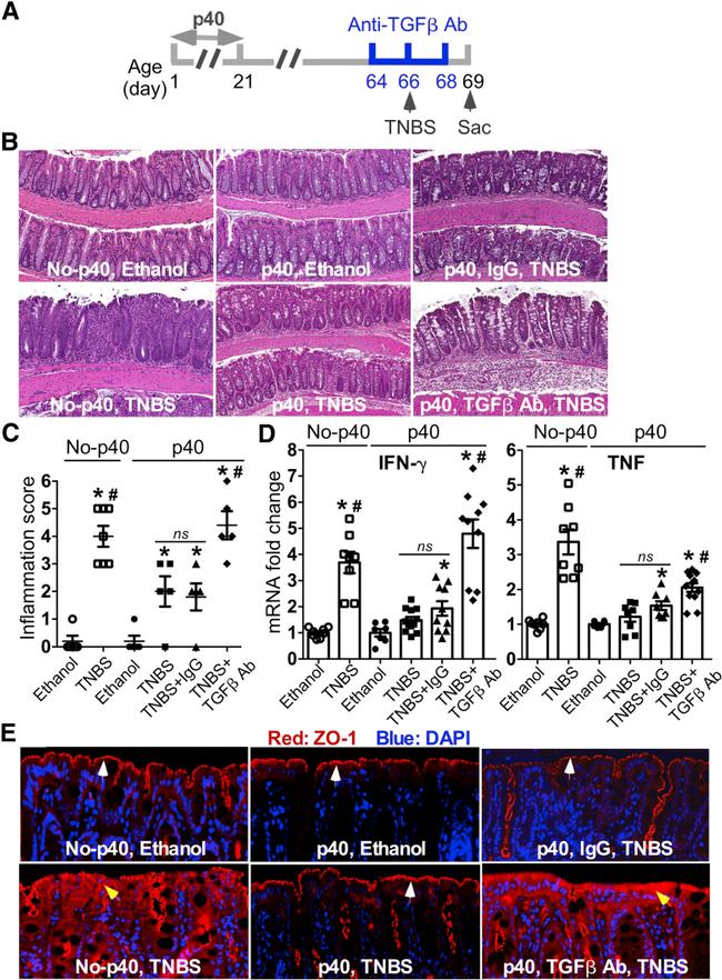 TGF beta-1,2,3 Antibody in Neutralization (Neu)