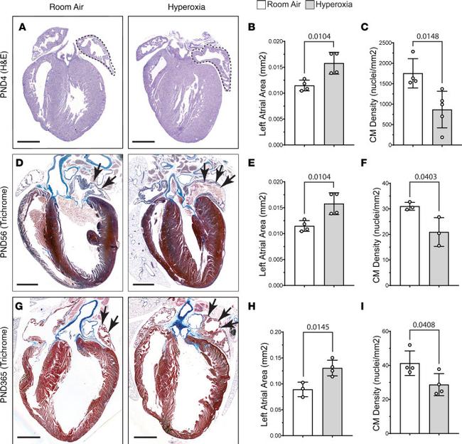 Cardiac Troponin T Antibody in Immunohistochemistry (PFA fixed) (IHC (PFA))