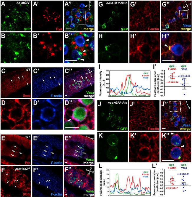 beta Galactosidase Antibody in Immunocytochemistry (ICC/IF)