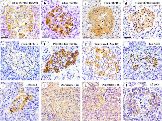 Phospho-Tau (Ser262) Antibody in Immunohistochemistry (IHC)