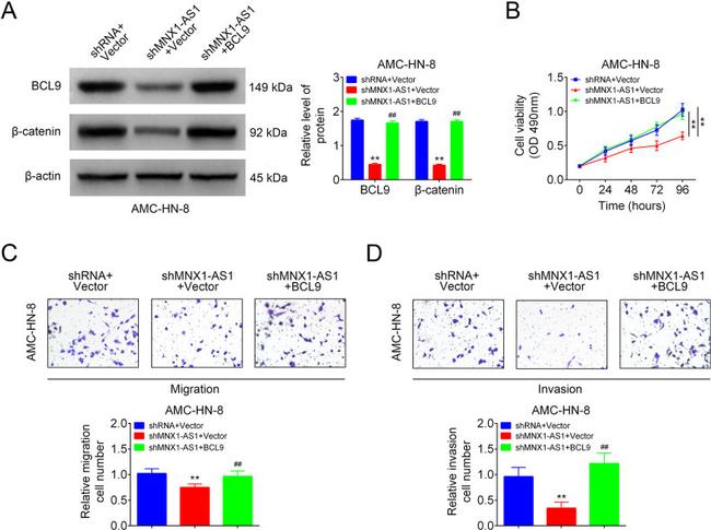 beta Catenin Antibody in Western Blot (WB)