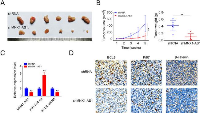 Ki-67 Antibody in Immunohistochemistry (IHC)