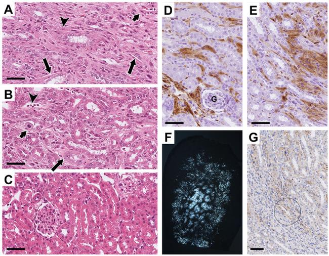 LAMP-2A Antibody in Immunohistochemistry (IHC)