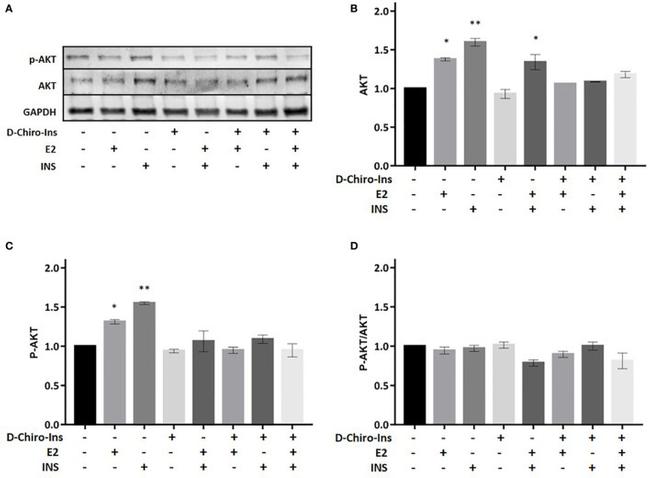 Phospho-AKT1 (Ser473) Antibody in Western Blot (WB)