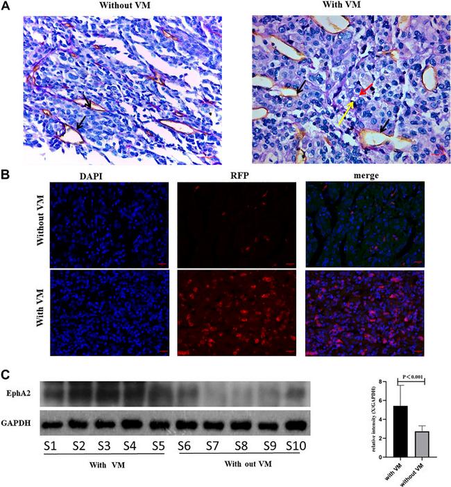 EphA2/EphA3/EphA4 Antibody in Immunohistochemistry (IHC)