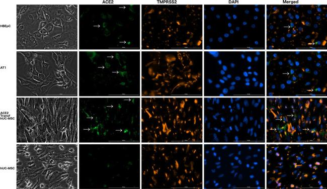 ACE2 Antibody in Immunocytochemistry (ICC/IF)