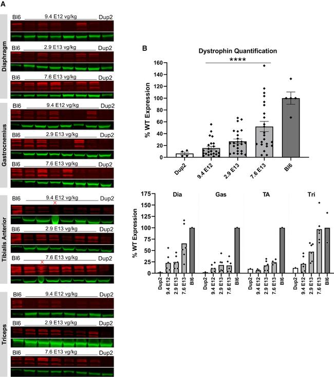 Sarcomeric alpha Actinin Antibody in Western Blot (WB)