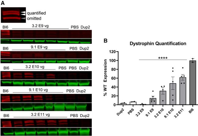 Sarcomeric alpha Actinin Antibody in Western Blot (WB)