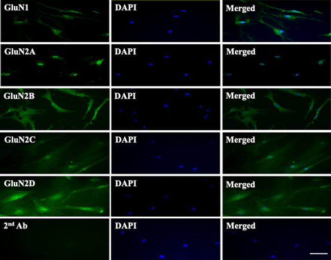 NMDAR2B Antibody in Immunocytochemistry (ICC/IF)