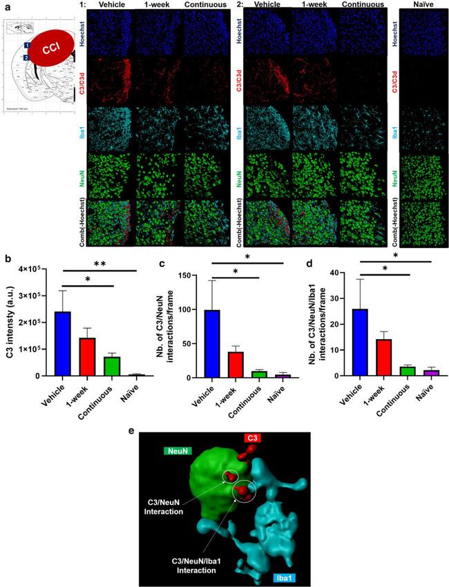 IBA1 Antibody in Immunohistochemistry (IHC)