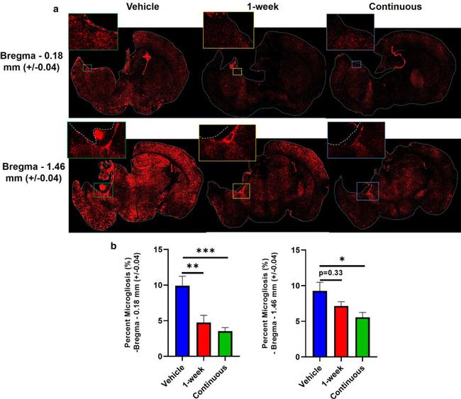 IBA1 Antibody in Immunohistochemistry (IHC)