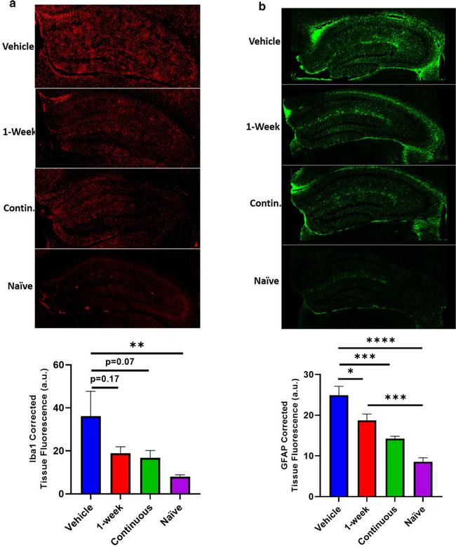 IBA1 Antibody in Immunohistochemistry (IHC)