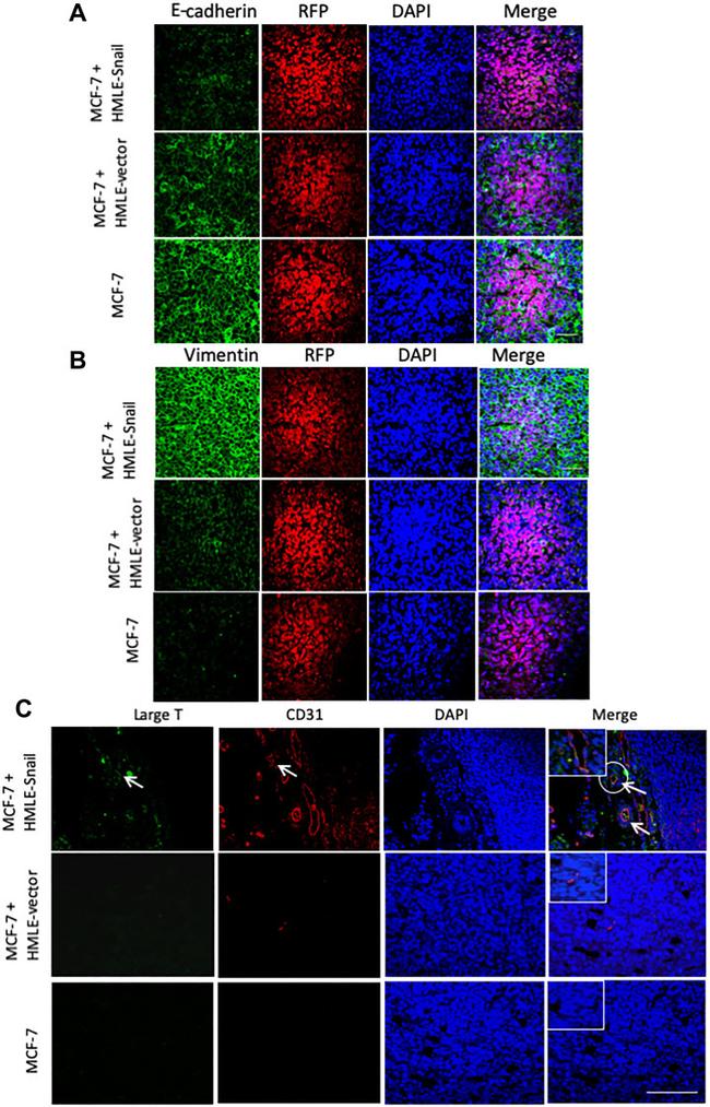 Vimentin Antibody in Immunohistochemistry (IHC)