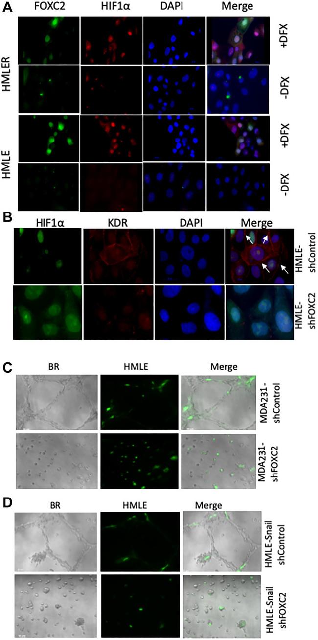 VEGF Receptor 2 Antibody in Immunocytochemistry (ICC/IF)