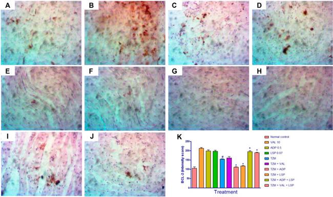 Bcl-2 Antibody in Immunohistochemistry (IHC)