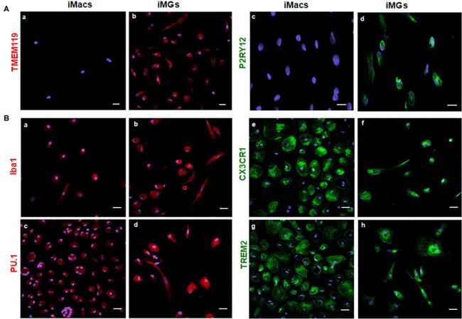 CX3CR1 Antibody in Immunohistochemistry (IHC)