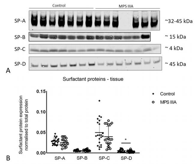 SFTPA1 Antibody in Western Blot (WB)