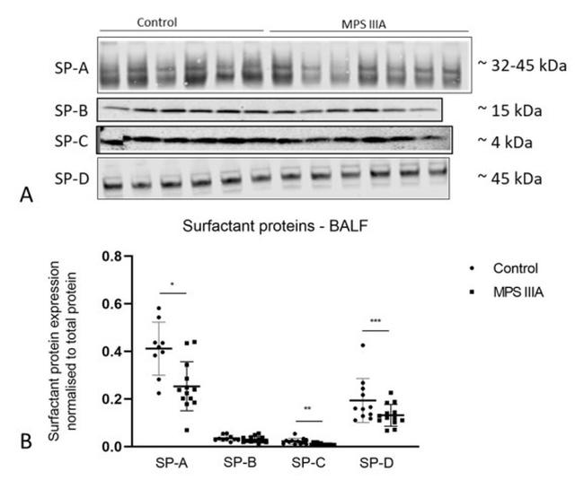 SFTPA1 Antibody in Western Blot (WB)