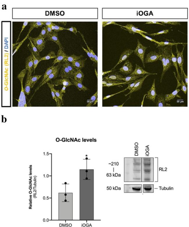 O-linked N-acetylglucosamine (O-GlcNAc) Antibody in Western Blot (WB)