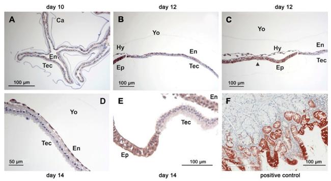 CBR1 Antibody in Immunohistochemistry (IHC)