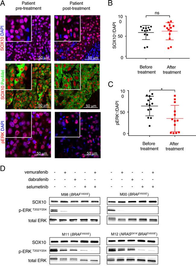 Phospho-ERK1/ERK2 (Thr185, Tyr187) Antibody in Immunohistochemistry (IHC)