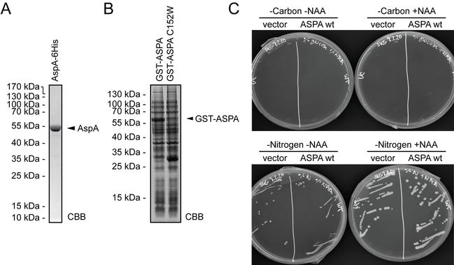 Aspartoacylase Antibody in Western Blot (WB)