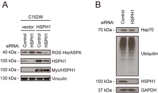 Aspartoacylase Antibody in Western Blot (WB)