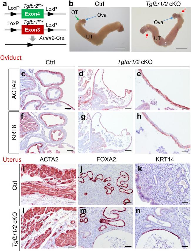 Cytokeratin 14 Antibody in Immunohistochemistry (IHC)