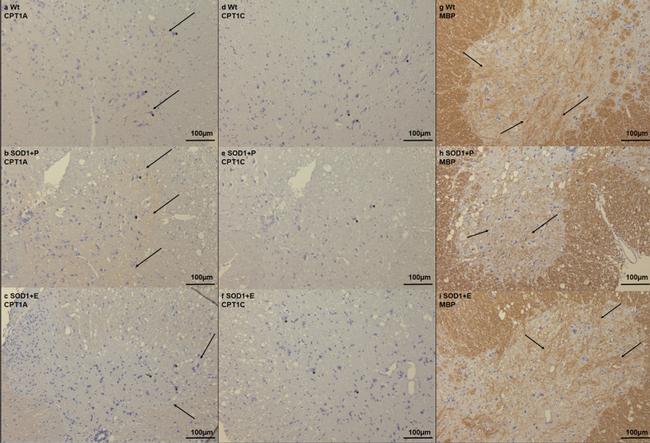 CPT1A Antibody in Immunohistochemistry (IHC)