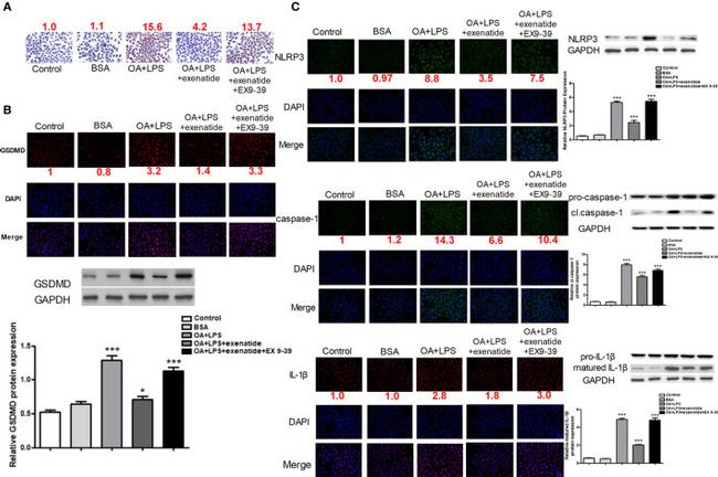 IL-1 beta Antibody in Immunocytochemistry (ICC/IF)