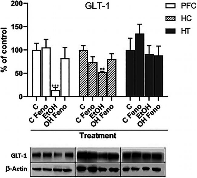 GLT-1 Antibody in Western Blot (WB)