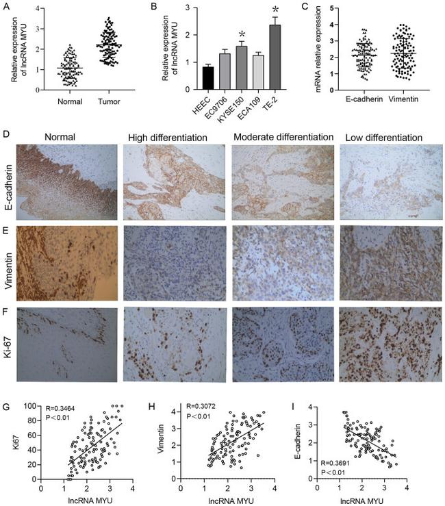 E-cadherin Antibody in Immunohistochemistry (IHC)