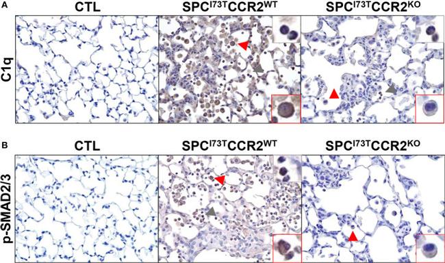 Phospho-SMAD3 (Ser425) Antibody in Immunohistochemistry (IHC)