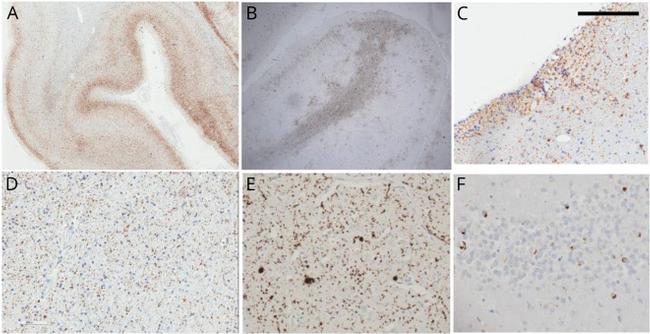 TDP-43 Antibody in Immunohistochemistry (IHC)