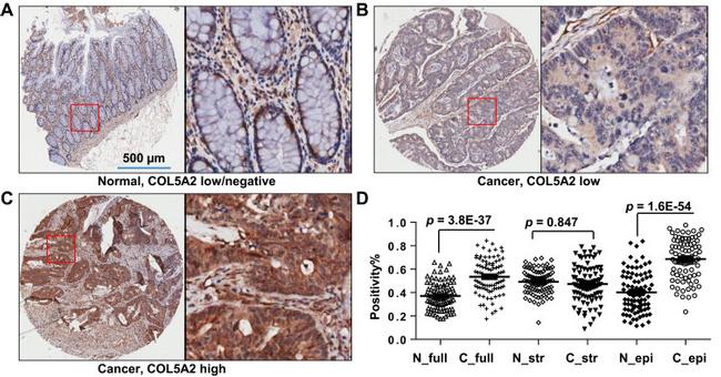 COL5A2 Antibody in Immunohistochemistry (IHC)