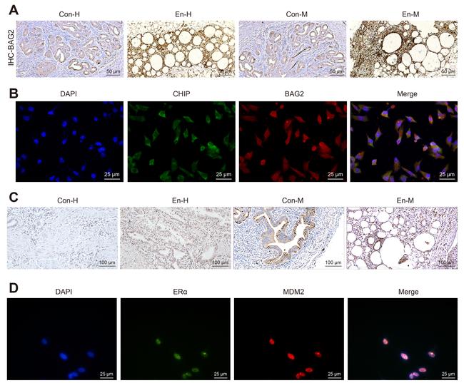 BAG2 Antibody in Immunocytochemistry, Immunohistochemistry (ICC/IF, IHC)