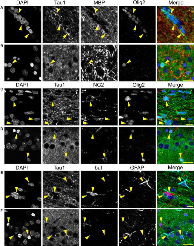 MBP Antibody in Immunocytochemistry (ICC/IF)