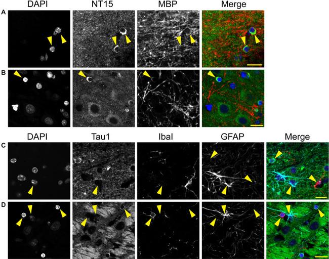 MBP Antibody in Immunohistochemistry (IHC)