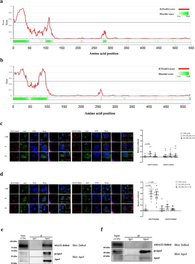 Apolipoprotein J Antibody in Western Blot, Immunoprecipitation (WB, IP)