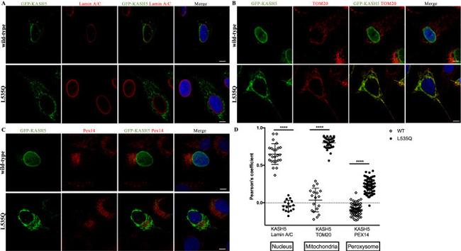 Lamin A/C Antibody in Immunocytochemistry (ICC/IF)